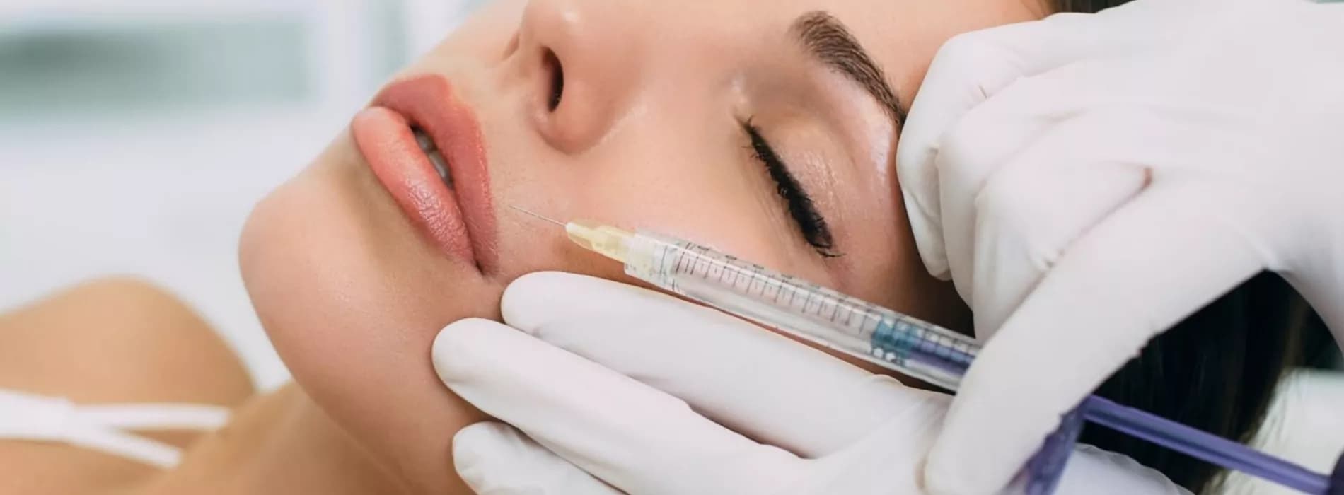 Lippenunterspritzung und Hautstraffung mit Hyaluron Nürnberg bei MY AESTHETICS