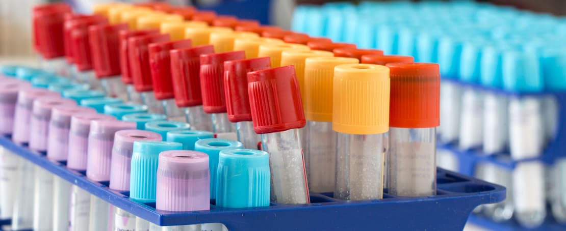 Sichere Diagnosen basieren auf exakter Präanalytik der Blutabnahme