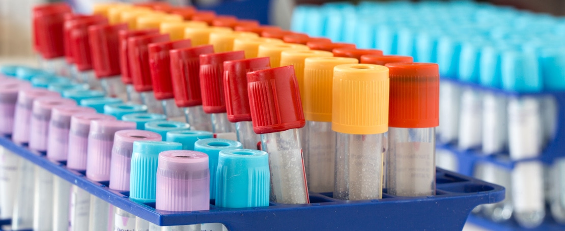 Sichere Diagnosen basieren auf exakter Präanalytik der Blutabnahme